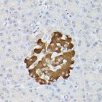 Insulin Polyclonal Antibody
