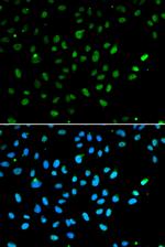 BRG1 Polyclonal Antibody