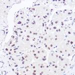 BRG1 Antibody in Immunohistochemistry (Paraffin) (IHC (P))
