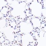 BRG1 Antibody in Immunohistochemistry (Paraffin) (IHC (P))