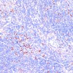 Zyxin Antibody in Immunohistochemistry (Paraffin) (IHC (P))
