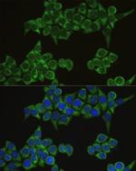 IRF3 Antibody in Immunocytochemistry (ICC/IF)