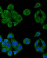 IRF3 Antibody in Immunocytochemistry (ICC/IF)
