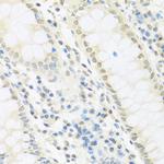 IRF3 Antibody in Immunohistochemistry (Paraffin) (IHC (P))