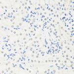 IRF3 Antibody in Immunohistochemistry (Paraffin) (IHC (P))