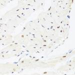 IRF3 Antibody in Immunohistochemistry (Paraffin) (IHC (P))