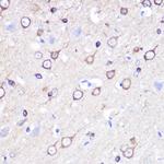Stathmin 1 Polyclonal Antibody