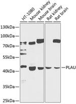 Urokinase Polyclonal Antibody
