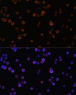 PLCG2 Antibody in Immunocytochemistry (ICC/IF)