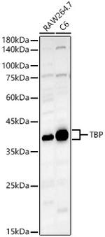 TBP Polyclonal Antibody