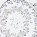 MRP4 Antibody in Immunohistochemistry (Paraffin) (IHC (P))