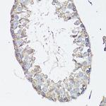 MRP4 Antibody in Immunohistochemistry (Paraffin) (IHC (P))