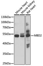 MBD2 Polyclonal Antibody