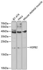 HSPB2 Antibody in Western Blot (WB)