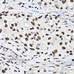 Histone H3 Antibody in Immunohistochemistry (Paraffin) (IHC (P))