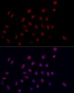 H3K9me2 Antibody in Immunocytochemistry (ICC/IF)