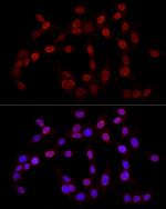 H3K27me3 Polyclonal Antibody