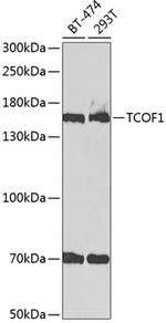 TCOF1 Polyclonal Antibody
