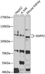ENPP2 Polyclonal Antibody