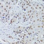 MRE11 Polyclonal Antibody