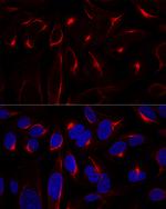 Vimentin Polyclonal Antibody