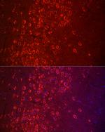 APLP1 Polyclonal Antibody