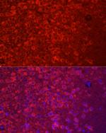 APLP1 Antibody in Immunohistochemistry (Paraffin) (IHC (P))