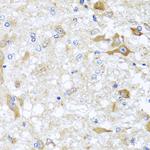 ABCB8 Antibody in Immunohistochemistry (Paraffin) (IHC (P))