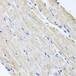 ABCB8 Antibody in Immunohistochemistry (Paraffin) (IHC (P))