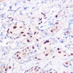 p21 Polyclonal Antibody