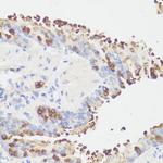 EEF1G Antibody in Immunohistochemistry (Paraffin) (IHC (P))