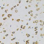 EEF1G Antibody in Immunohistochemistry (Paraffin) (IHC (P))