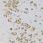 EEF1G Antibody in Immunohistochemistry (Paraffin) (IHC (P))