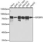 IGF2BP3 Polyclonal Antibody