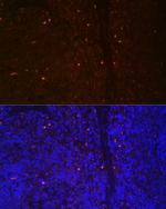 RUNX2 Polyclonal Antibody