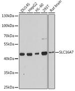 MCT2 Polyclonal Antibody