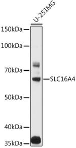 SLC16A4 Antibody in Western Blot (WB)