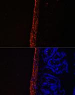 MYL9 Antibody in Immunohistochemistry (Paraffin) (IHC (P))