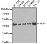 PAR4 Polyclonal Antibody