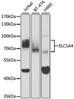 SLC1A4 Antibody in Western Blot (WB)