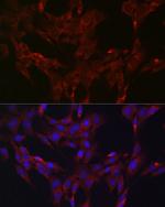 MKP3 Polyclonal Antibody