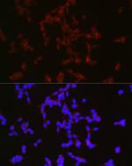 NPY Polyclonal Antibody