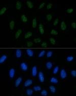 MNAR Polyclonal Antibody