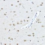 TWIST1 Antibody in Immunohistochemistry (Paraffin) (IHC (P))