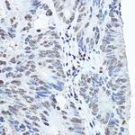 TWIST1 Polyclonal Antibody