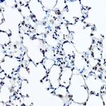 TWIST1 Antibody in Immunohistochemistry (Paraffin) (IHC (P))