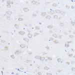 UBE4A Polyclonal Antibody