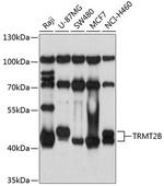 TRMT2B Polyclonal Antibody