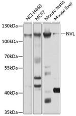 NVL Antibody in Western Blot (WB)
