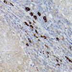 UBE2L6 Polyclonal Antibody